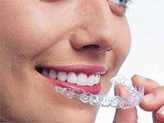 Invisalign